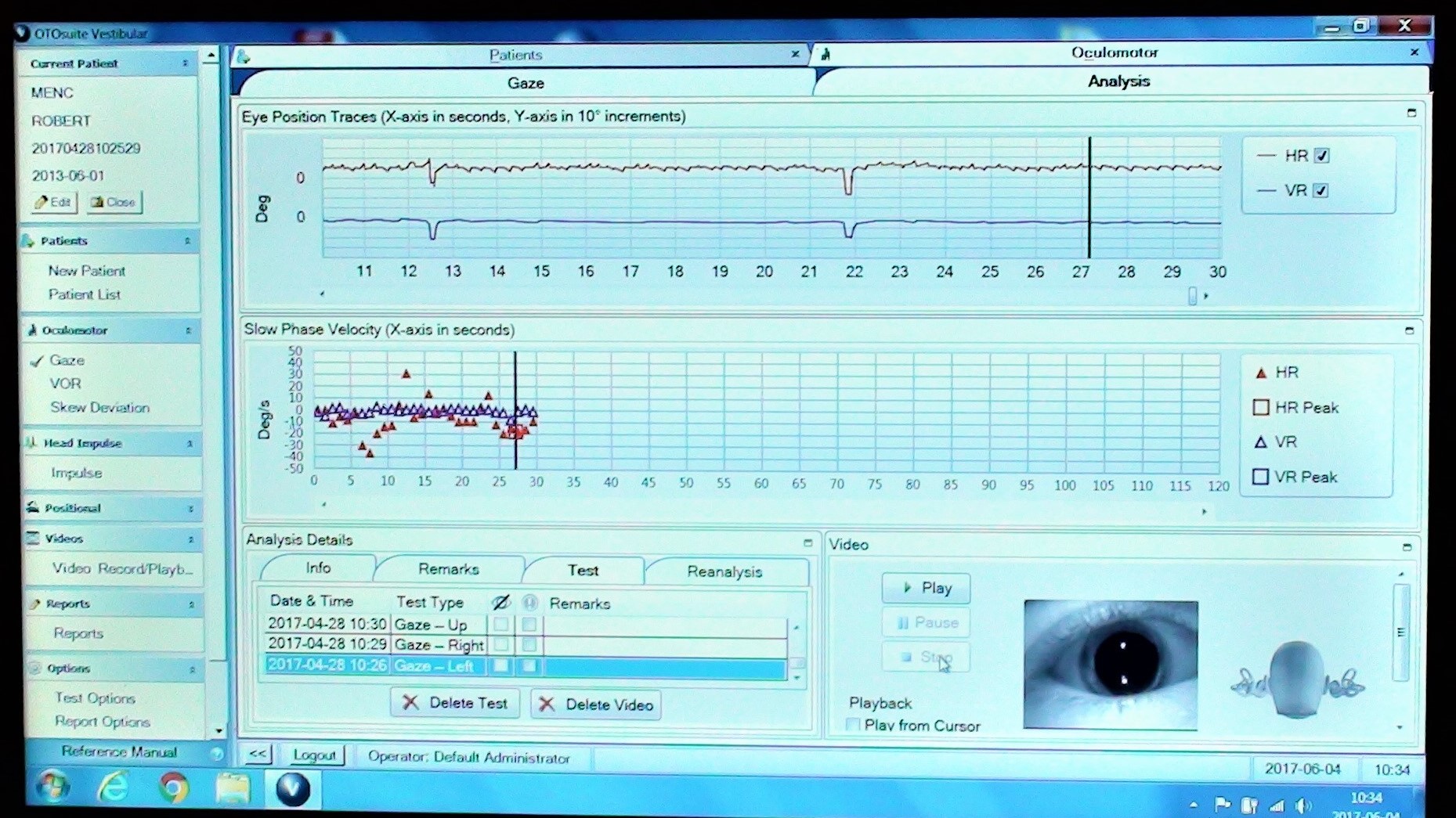 ics impulse oczoplas